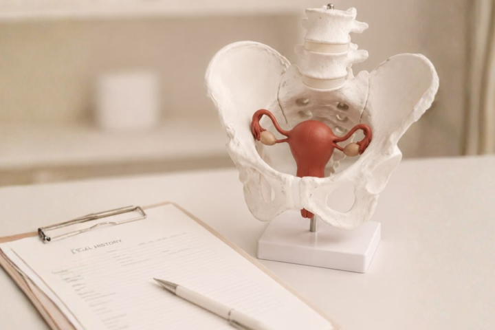 Pelvic Organ Prolapse