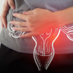 Recurrent UTI in women causes prevention and treatment