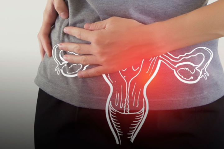 Recurrent UTI in women causes prevention and treatment
