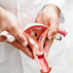 vaginismus treatment in india